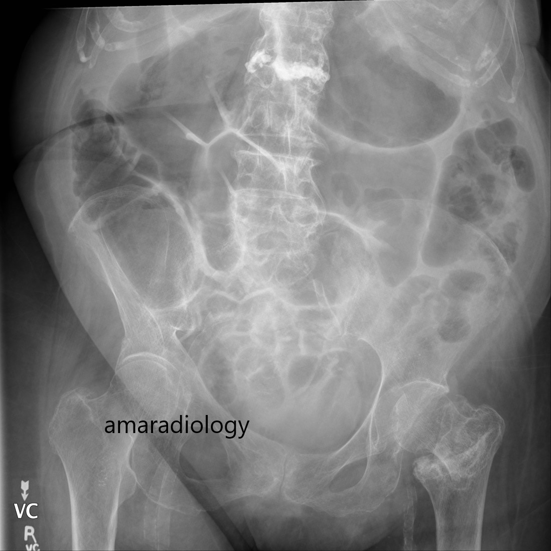 Case 20